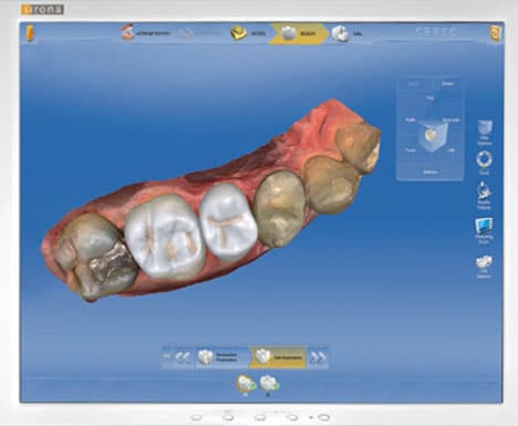 ConeBeam Scanner